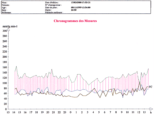 Mesure de l'hypertension sur 24 heures